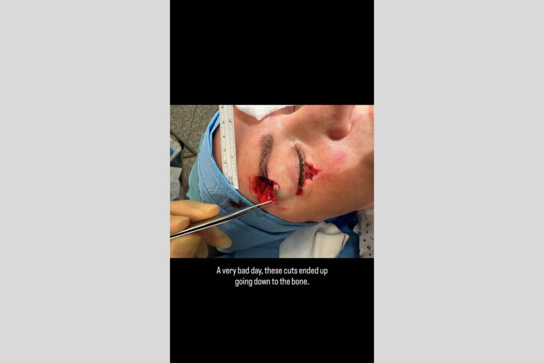 Laura Woods deelt een heftige foto